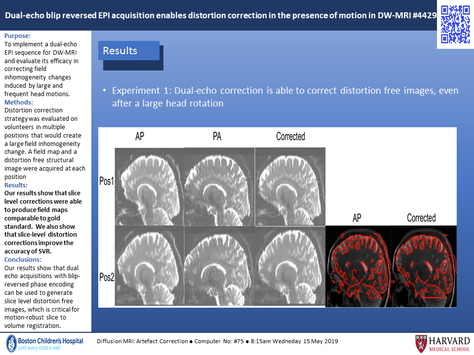 ISMRM2019_6