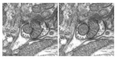 Neural Ultrastructure Alignment